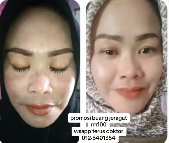 Testimoni